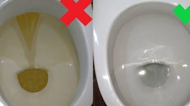 Nije sirće ni soda bikarbona: Ovo sredstvo najbolje uklanja kamenac u WC šolji Nije sirće ni soda bikarbona: Ovo sredstvo najbolje uklanja kamenac u WC šolji - featured image