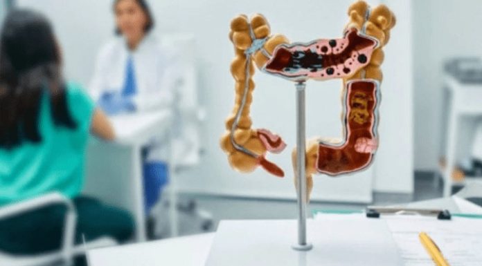 Rak debelog crijeva nije samo krv u stolici: 0vaj simptom niko ne povezuje sa karcinomom – A TREBA0 BI! Rak debelog crijeva nije samo krv u stolici: 0vaj simptom niko ne povezuje sa karcinomom – A TREBA0 BI! - featured image